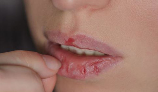 �촽������Ƥ��ô�� �촽������Ƥ����ȷ����